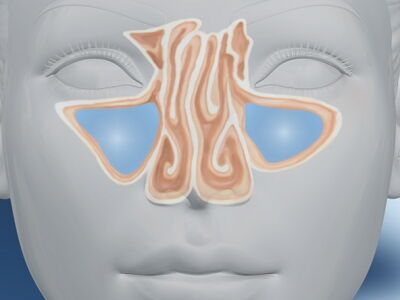 Anatomie Nasen-OP