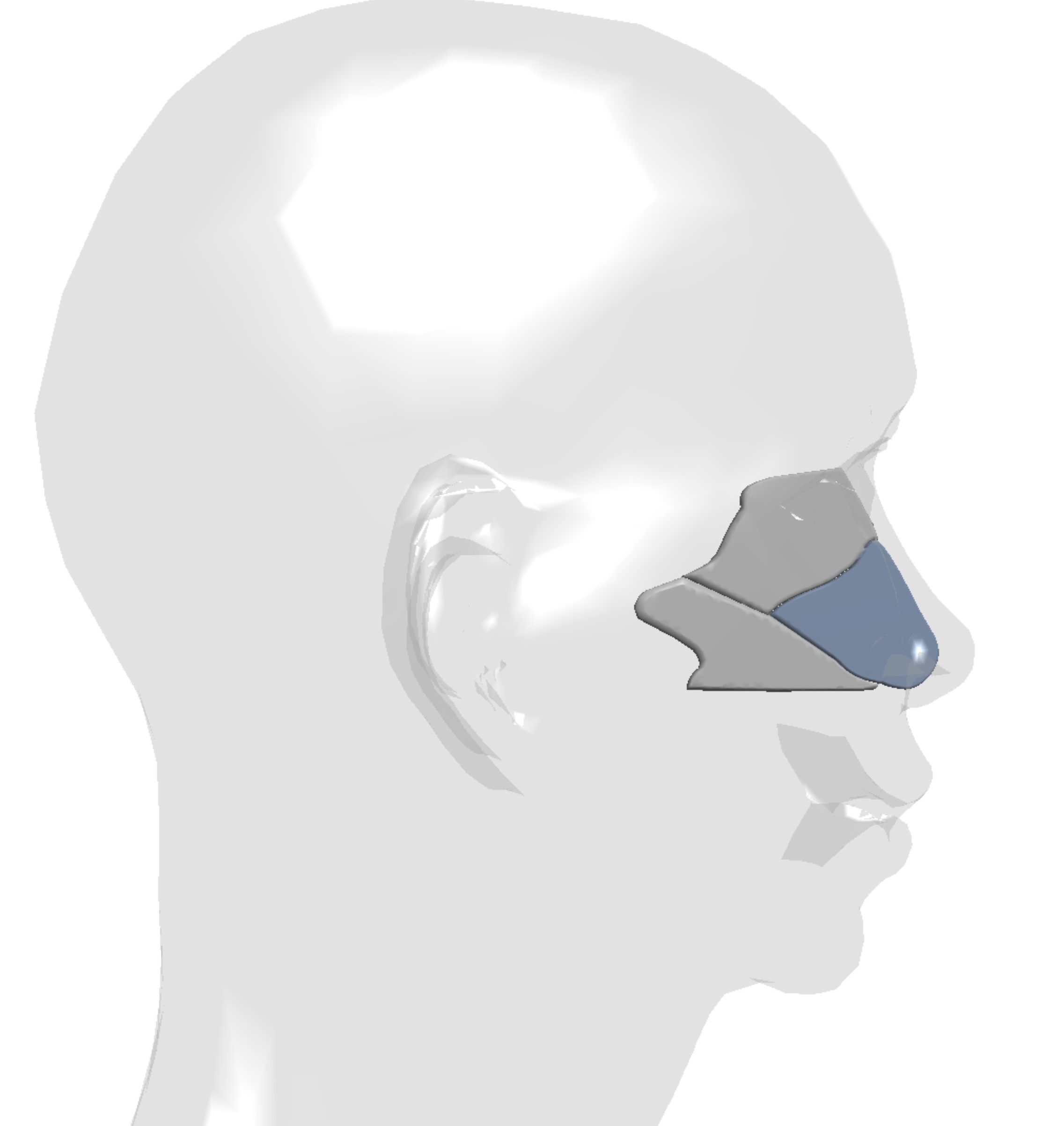 Nasenseptum - Nasenoperation